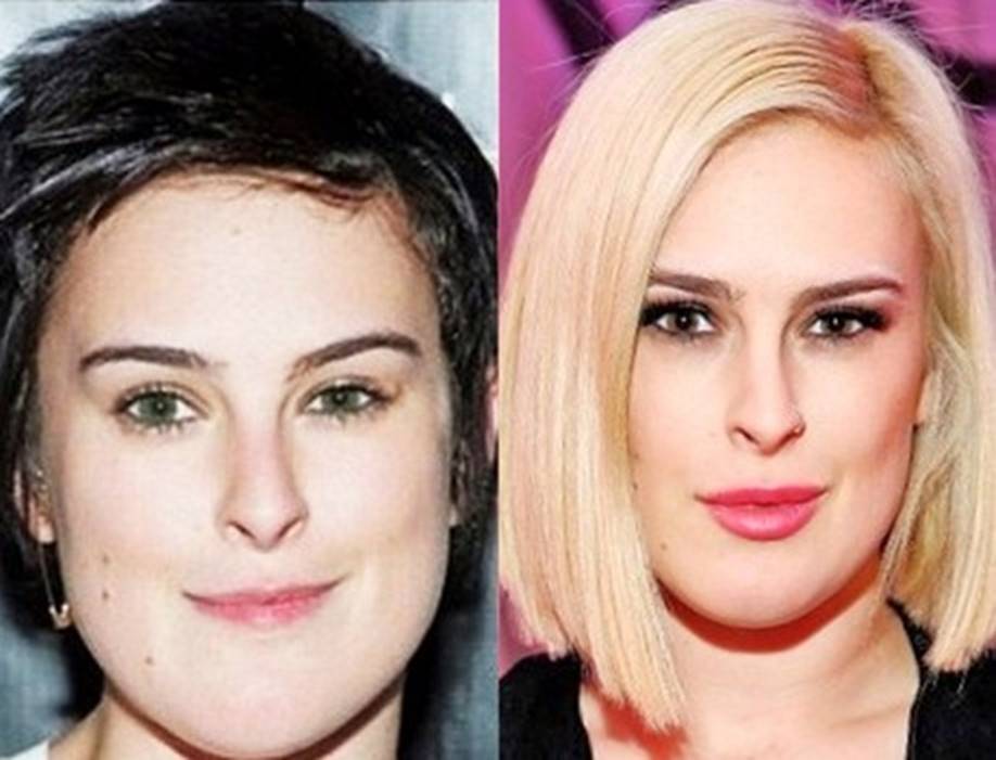 Searching for Perfection: Rumer Willis Before and After Plastic Surgery ...